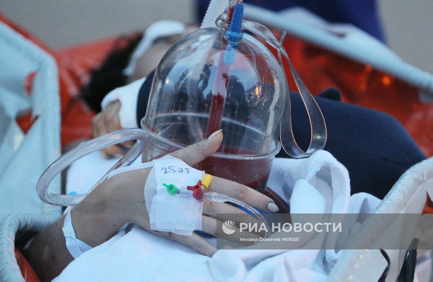 Гражданка России, пострадавшая в результате ДТП в Анталье