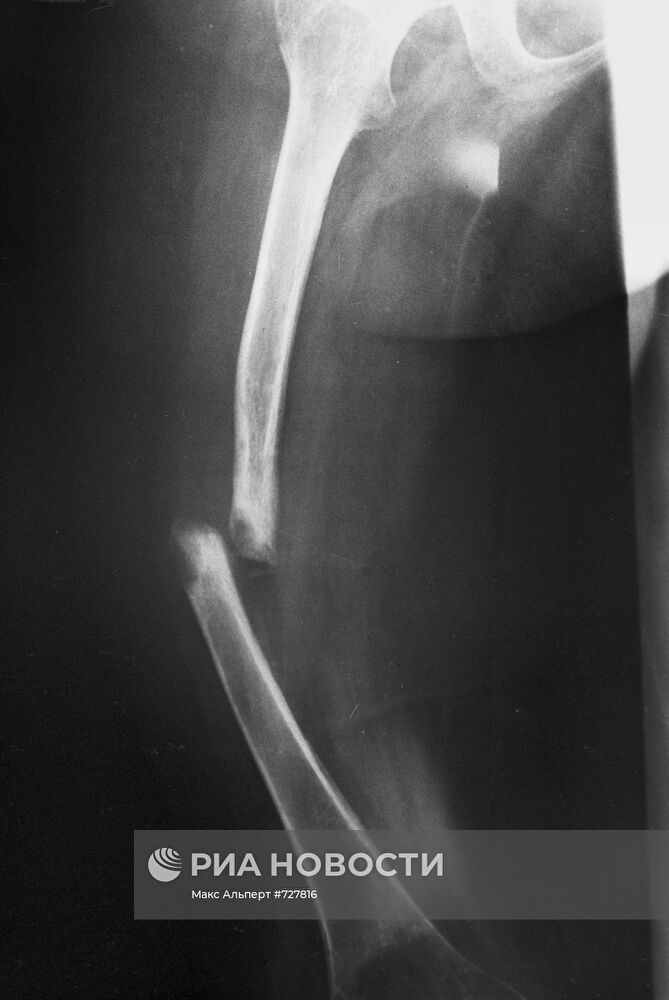 Центральный институт травматологии и ортопедии в Москве