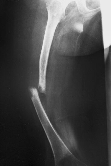 Центральный институт травматологии и ортопедии в Москве