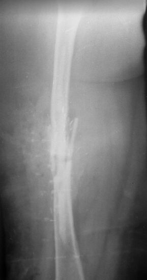 Центральный институт травматологии и ортопедии в Москве