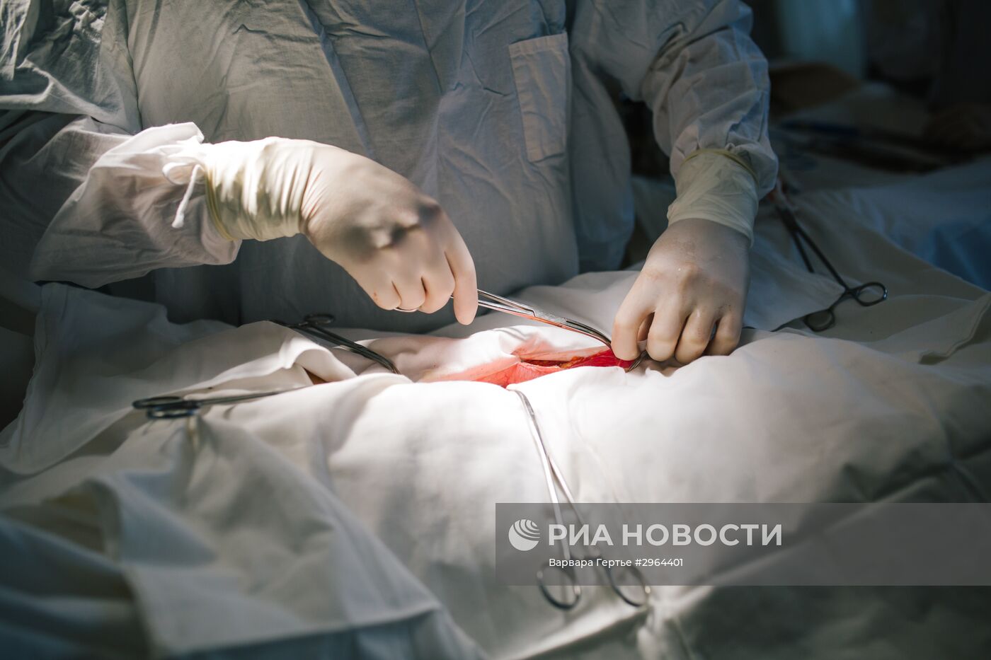 Операция по удалению злокачественной опухоли