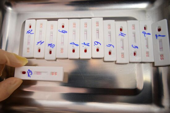 Экспресс-тестирование на ВИЧ в Казани