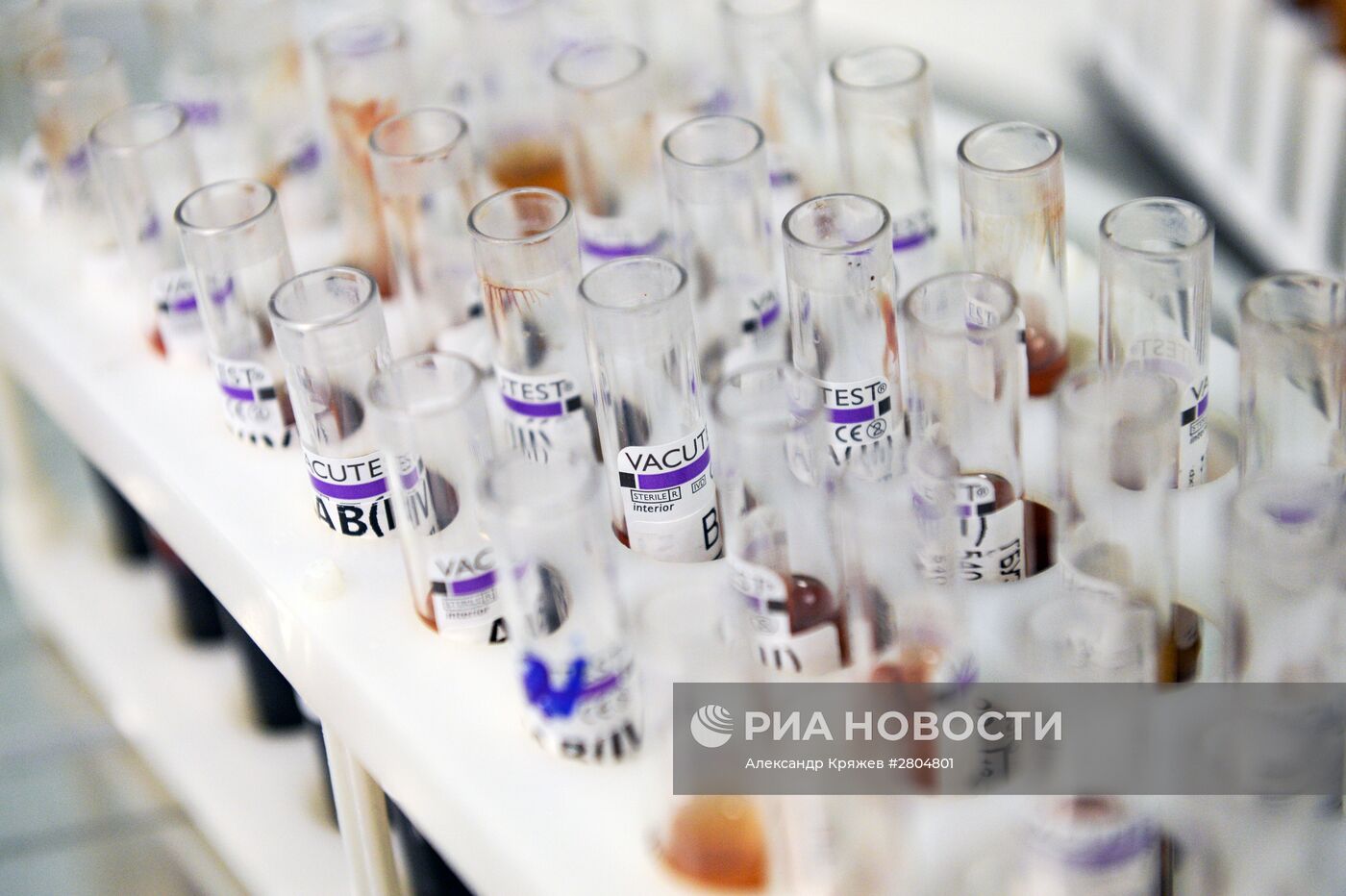 Новосибирский центр крови