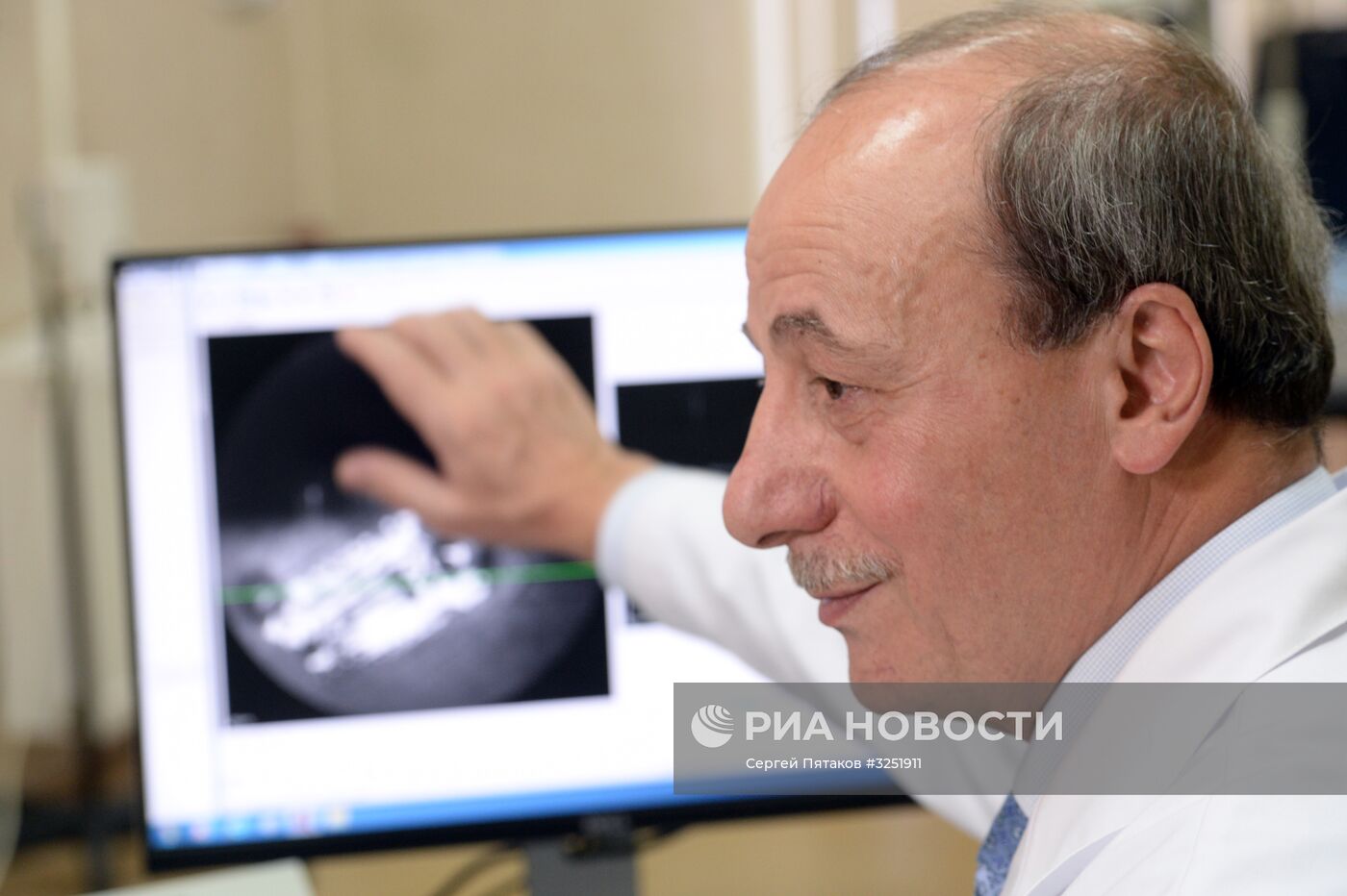 Бионический глаз установили пациентке в научно-клиническом центре отоларингологии РФ