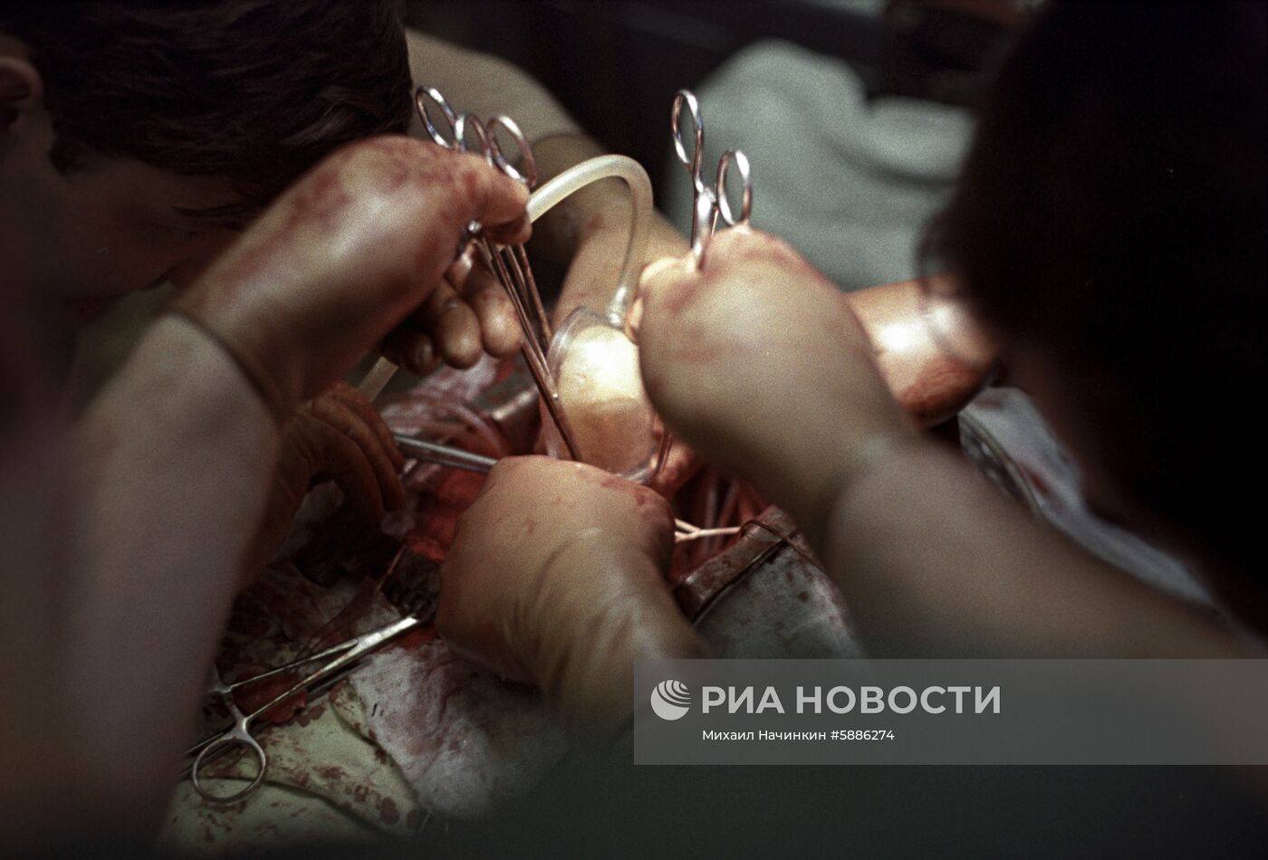 Всесоюзный научный центр хирургии АМН СССР