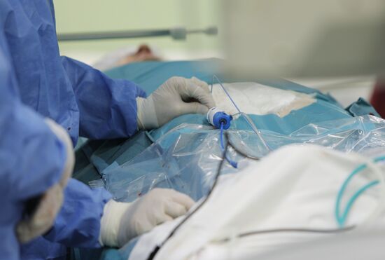 Операция по лечению аритмии с использованием метода криоаблации 