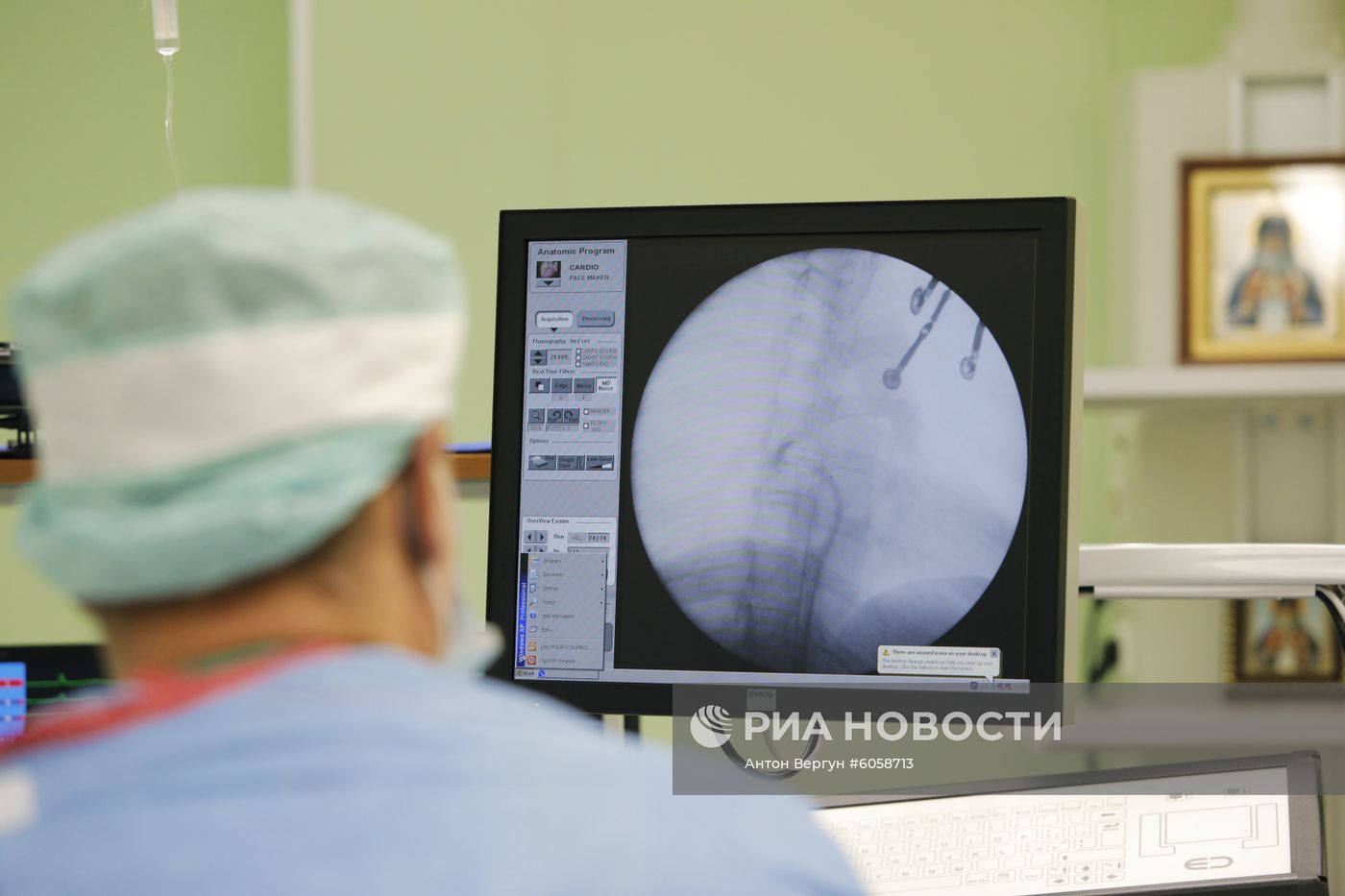 Операция по лечению аритмии с использованием метода криоаблации