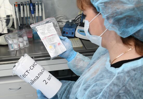 В Забайкалье поступила тест-система для определения антигена коронавируса