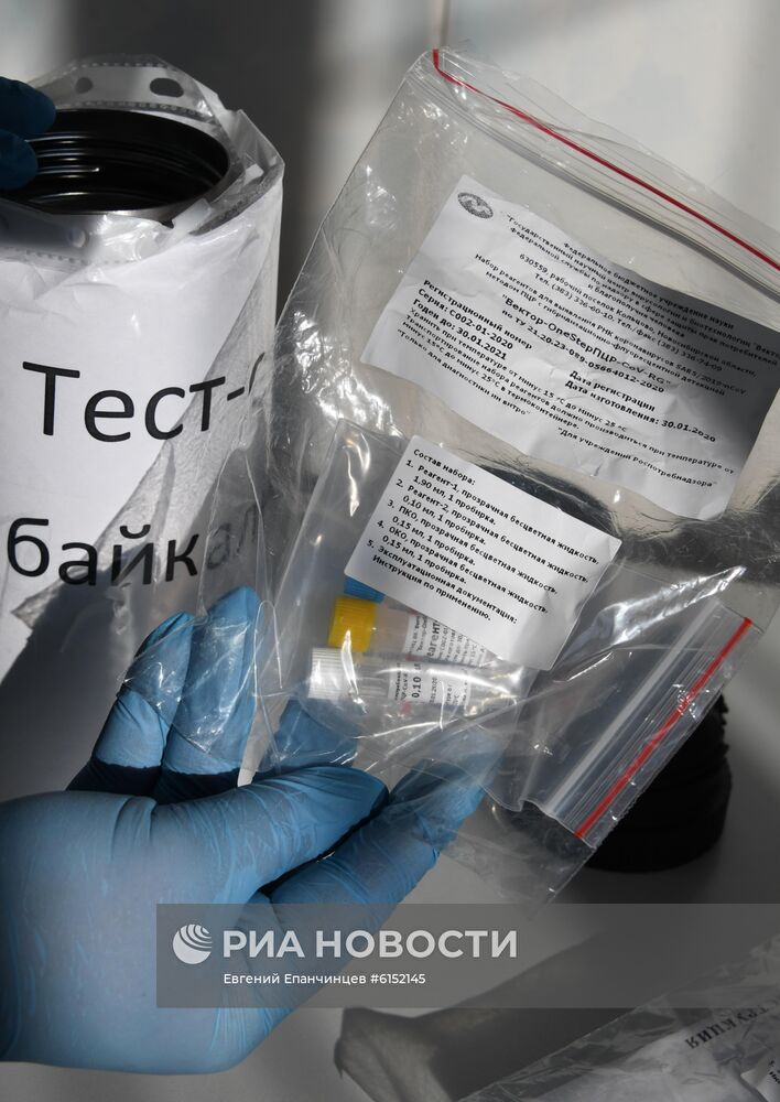 В Забайкалье поступила тест-система для определения антигена коронавируса