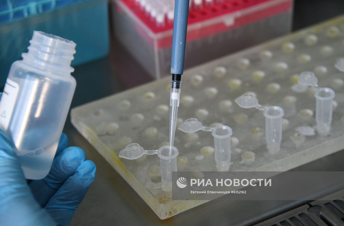 В Забайкалье поступила тест-система для определения антигена коронавируса