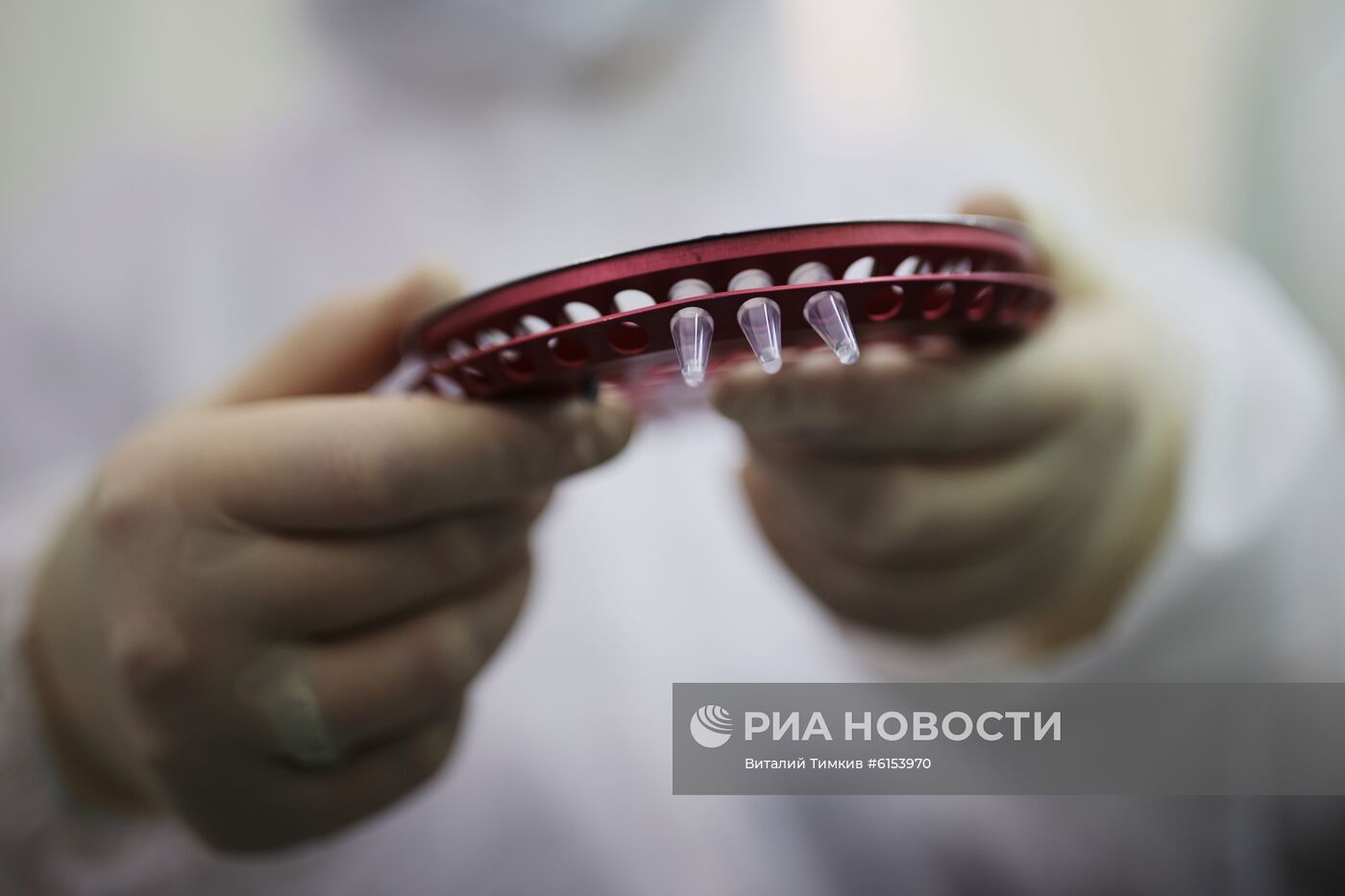 Тест-системы для диагностики нового коронавируса в Краснодаре