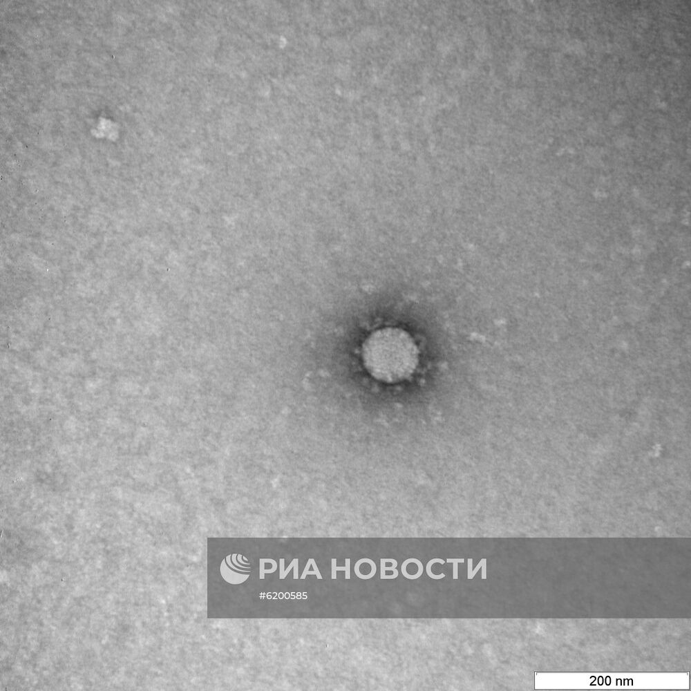 В России сделали фото частиц коронавируса 