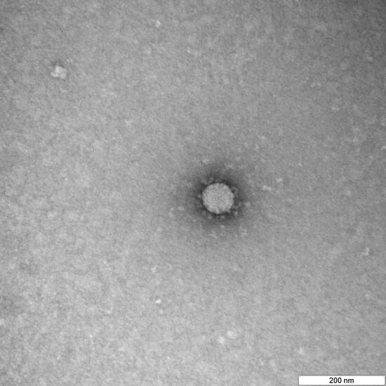 В России сделали фото частиц коронавируса 