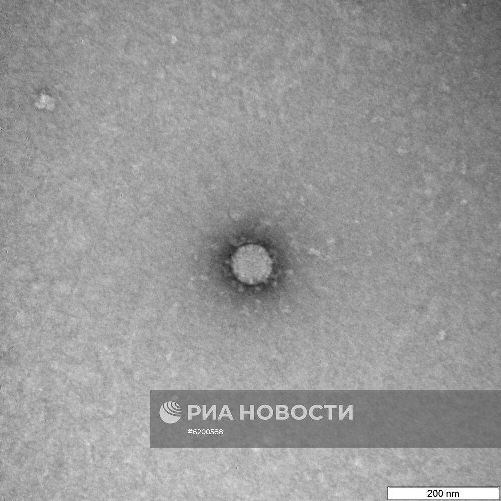 В России сделали фото частиц коронавируса