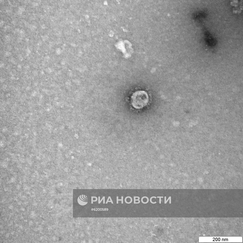 В России сделали фото частиц коронавируса