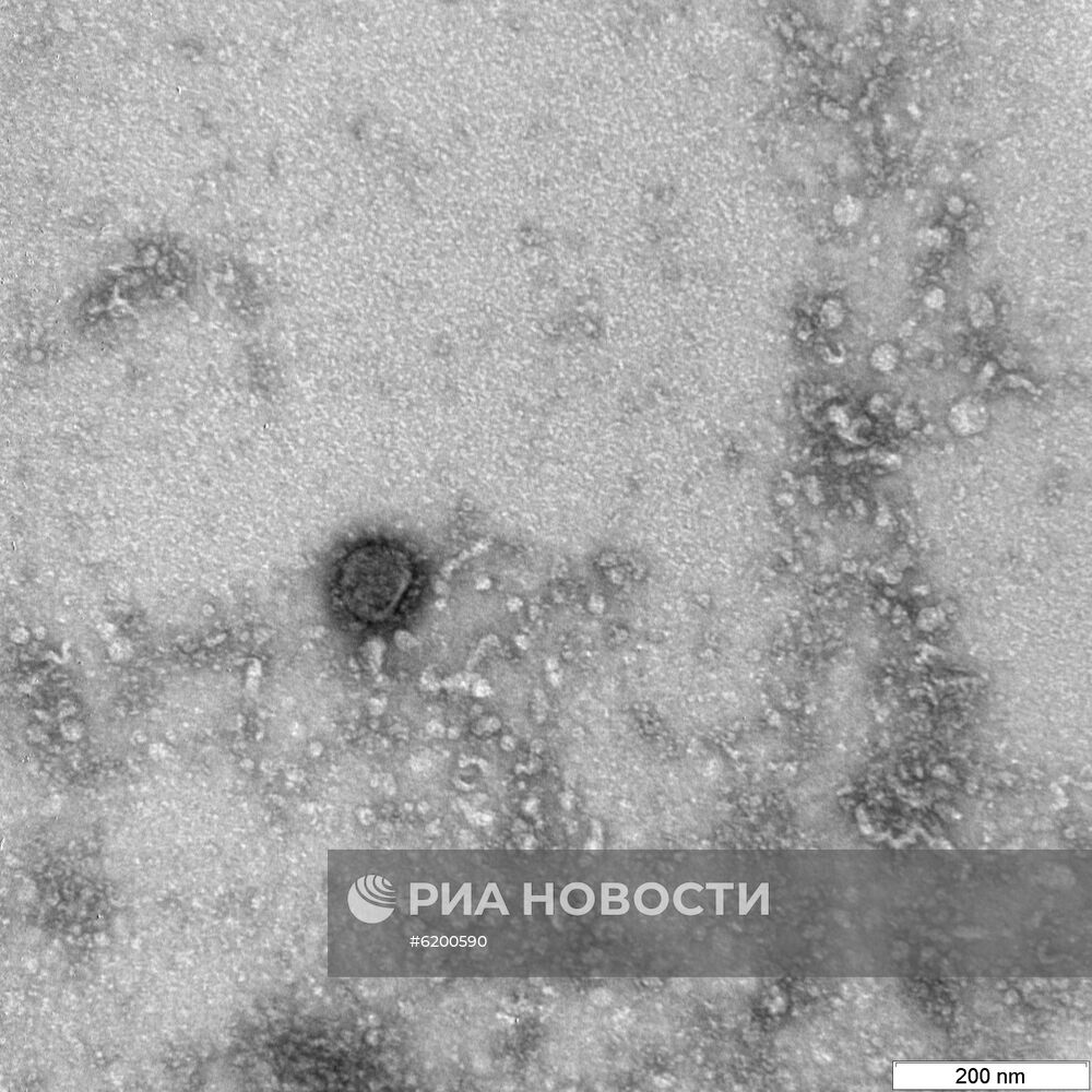 В России сделали фото частиц коронавируса