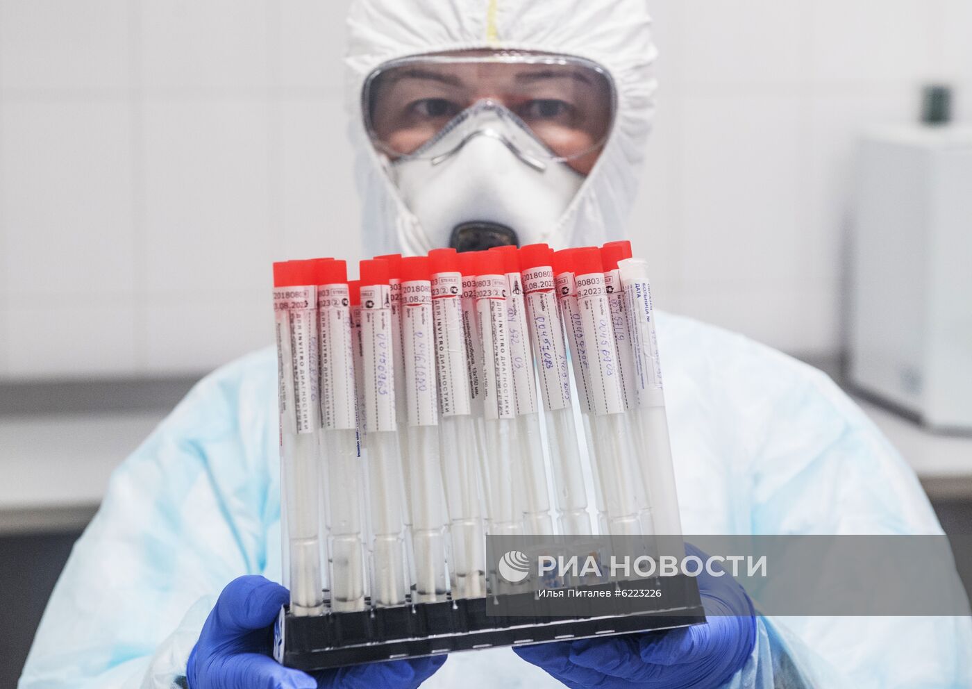 Лаборатория "Инвитро" начала тестирование на коронавирусную инфекцию 