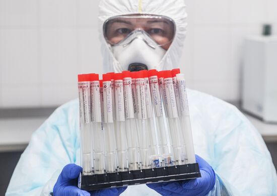 Лаборатория "Инвитро" начала тестирование на коронавирусную инфекцию 