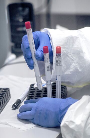 Лаборатория "Инвитро" начала тестирование на коронавирусную инфекцию 