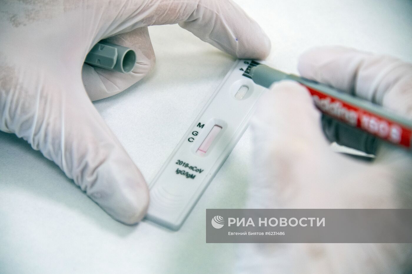 Экспресс-диагностика на антитела к коронавирусу в клинике Hadassah Medical Moscow в Сколково