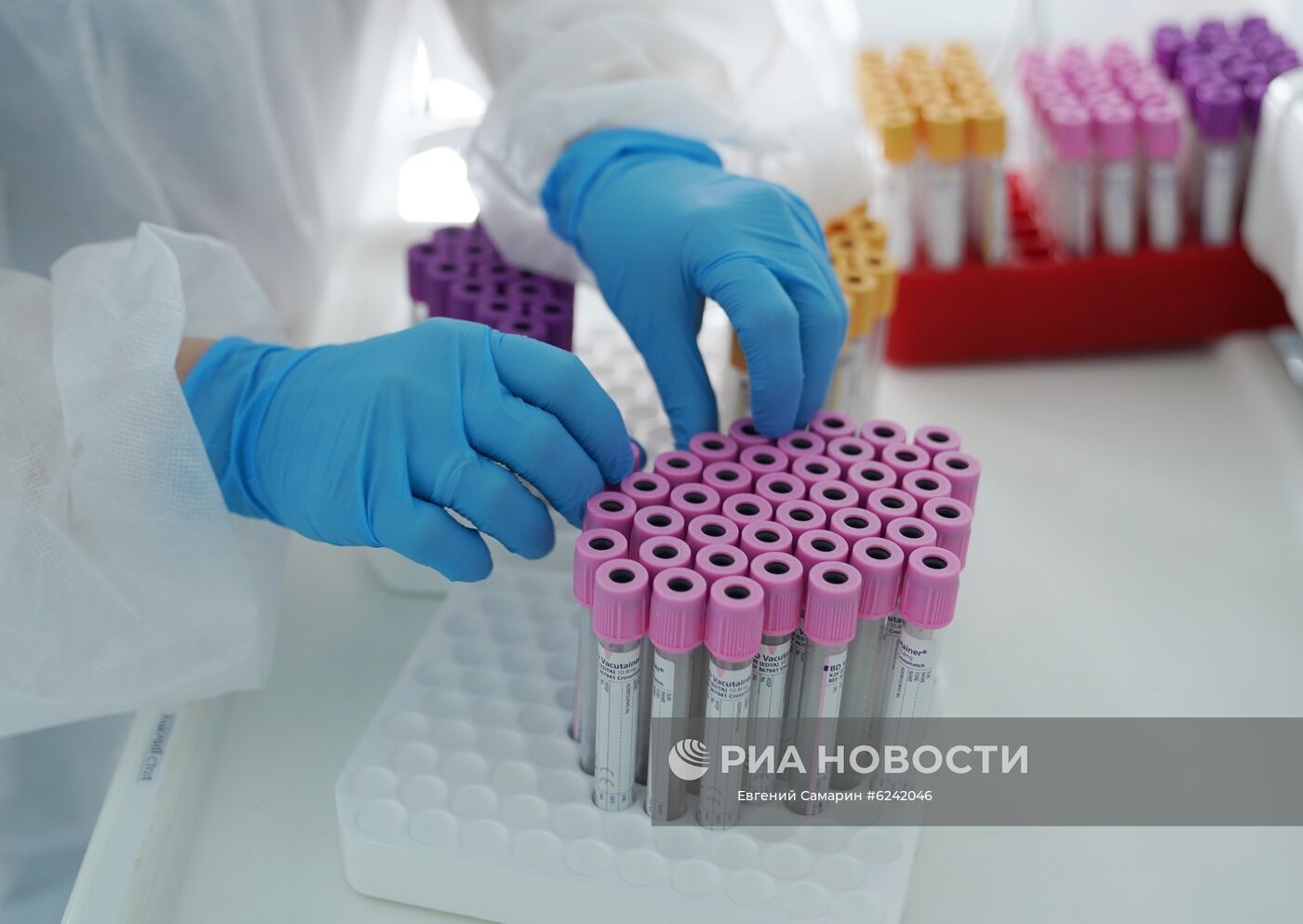 Центр крови имени О.К. Гаврилова принимает донорскую плазму COVREC