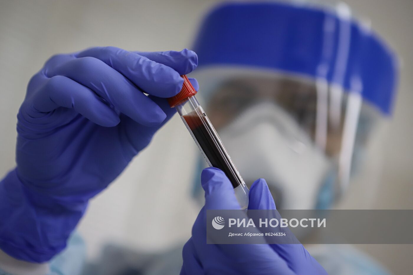 Тестирование на антитела к коронавирусу