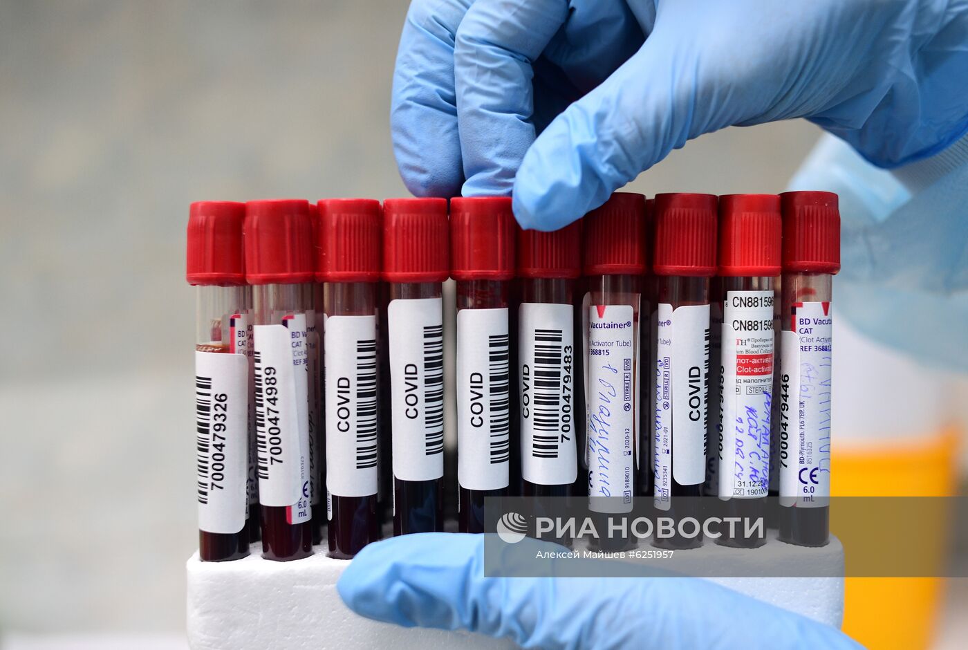 Тестирование на COVID-19 в лаборатории НИИ Склифосовского