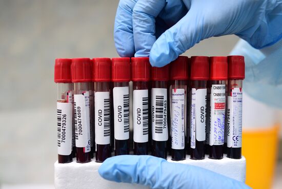 Тестирование на COVID-19 в лаборатории НИИ Склифосовского