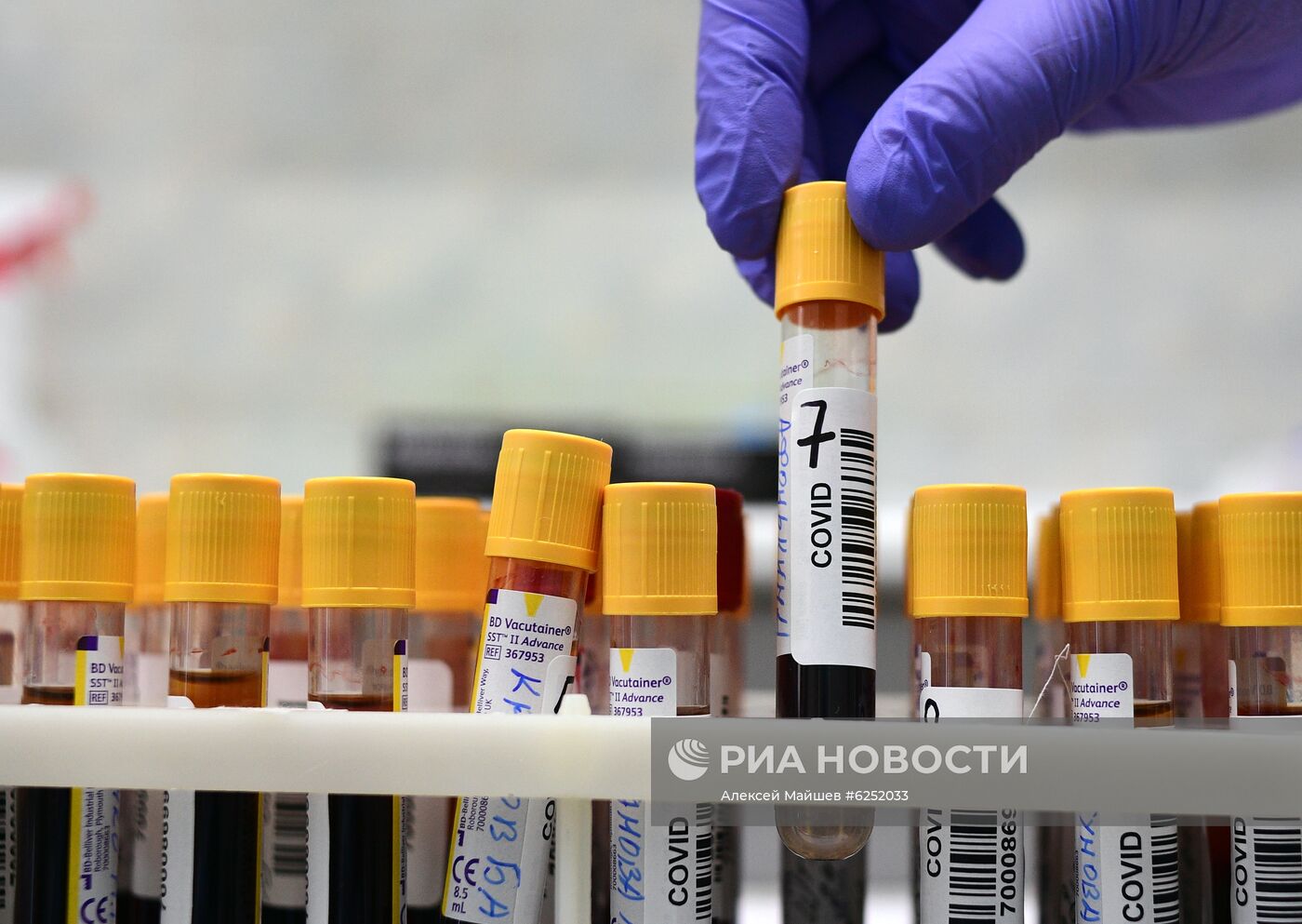 Тестирование на COVID-19 в лаборатории НИИ Склифосовского