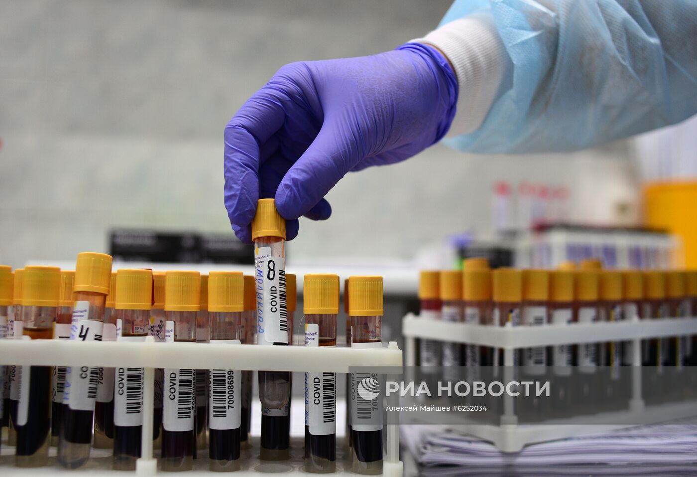 Тестирование на COVID-19 в лаборатории НИИ Склифосовского