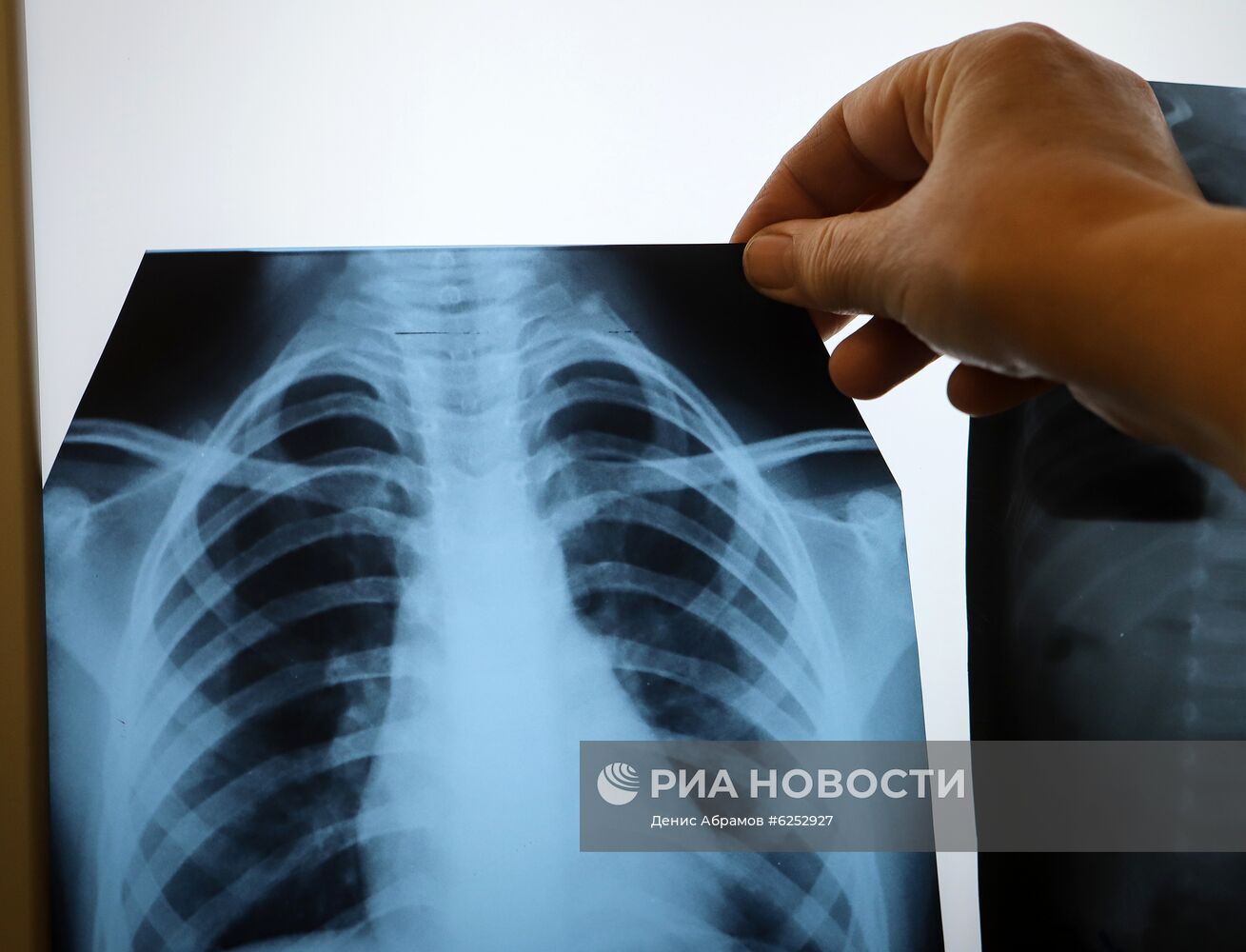 Республиканская детская больница во Владикавказе