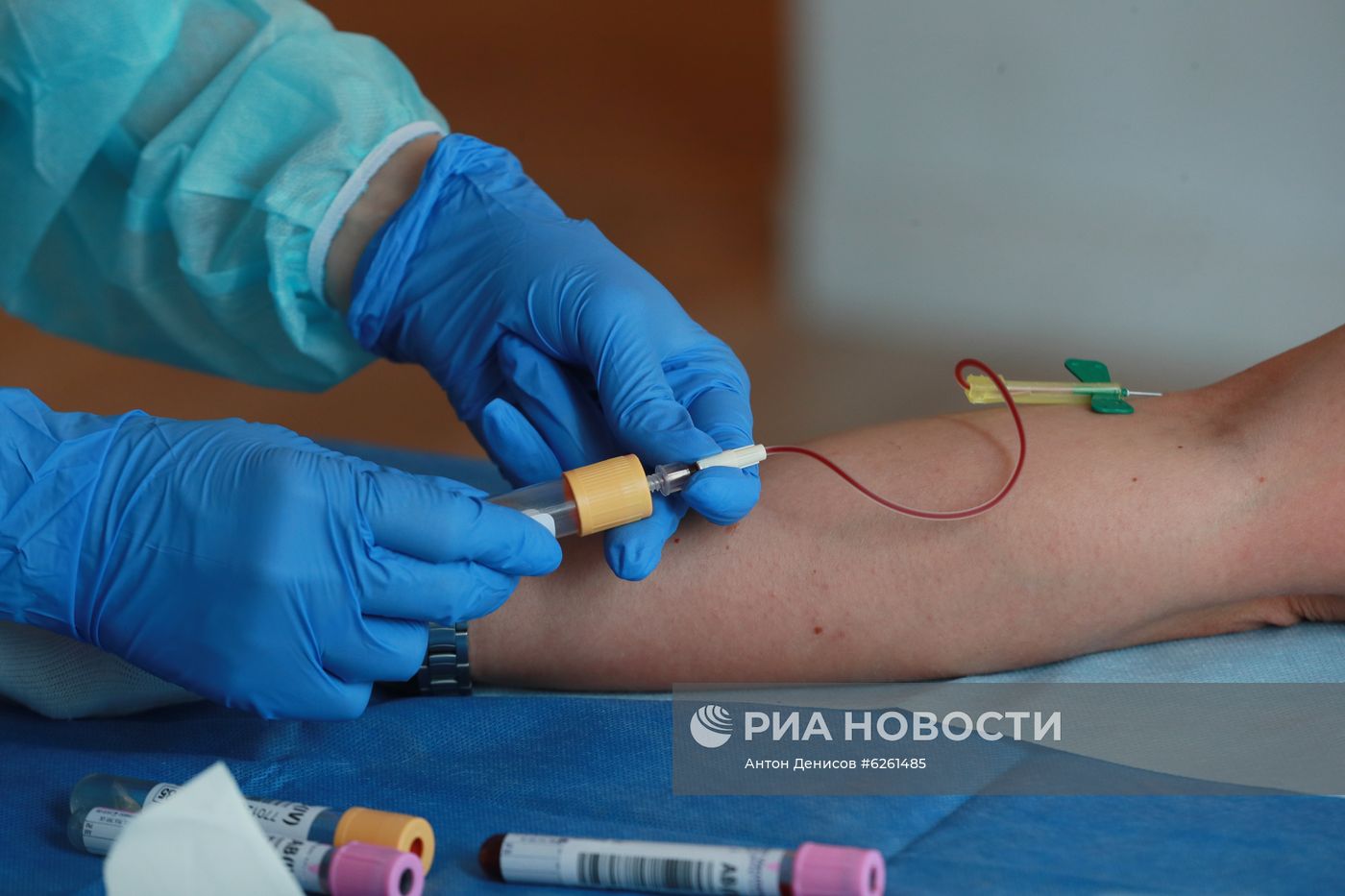 Тестирование на наличие антител к COVID-19 