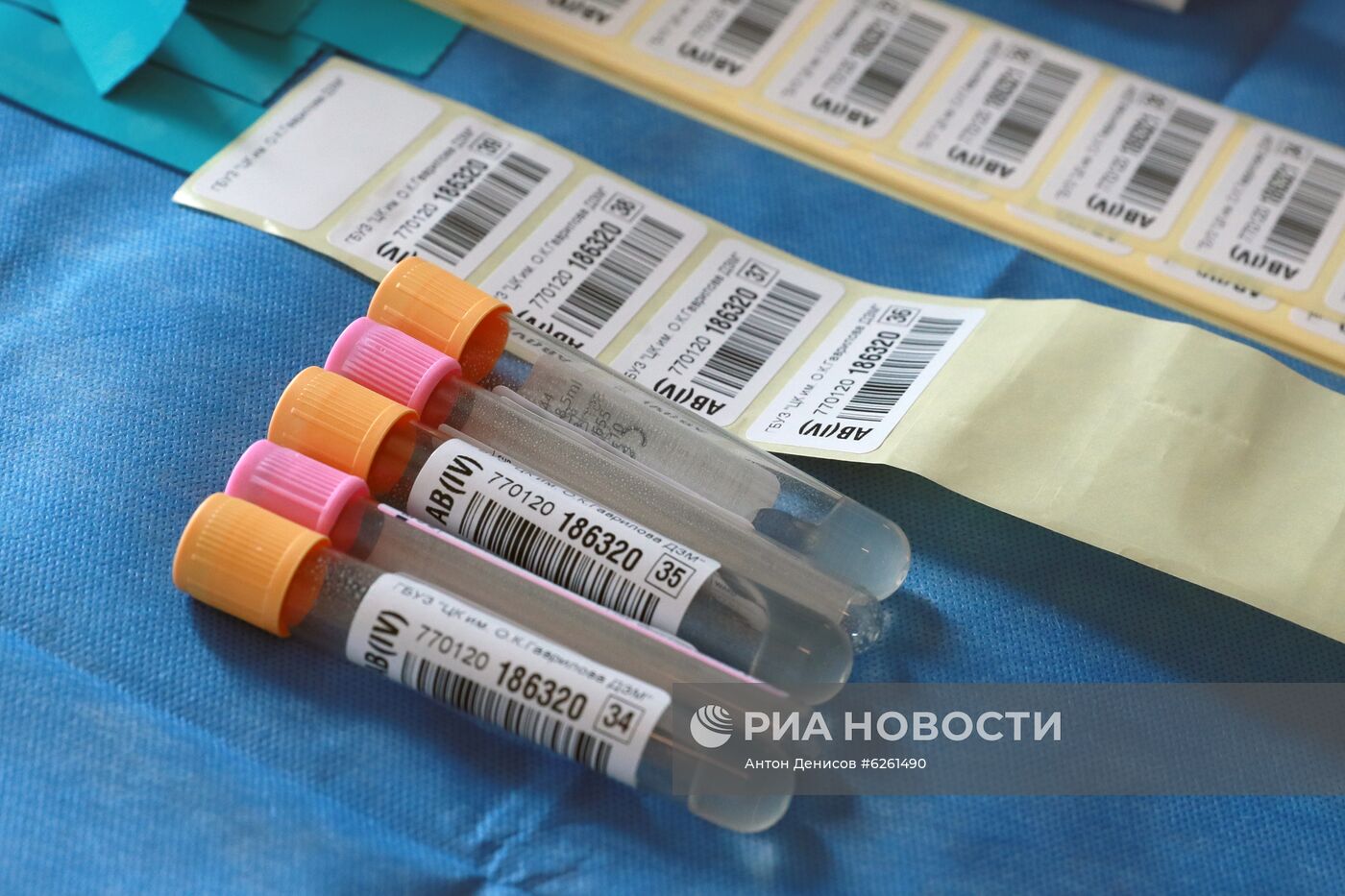 Тестирование на наличие антител к COVID-19