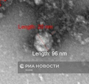 Учеными института "Вектор" получено первое изображение "британского" штамма нового коронавируса