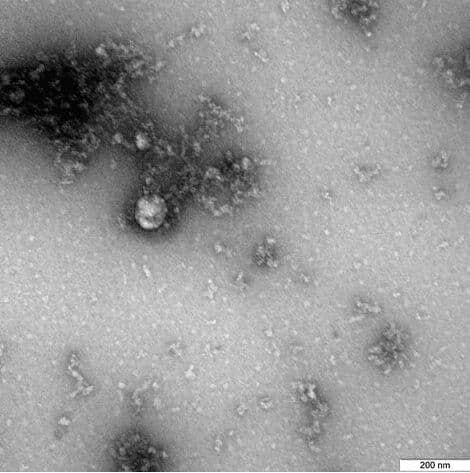 Учеными института "Вектор" получено первое изображение "британского" штамма нового коронавируса
