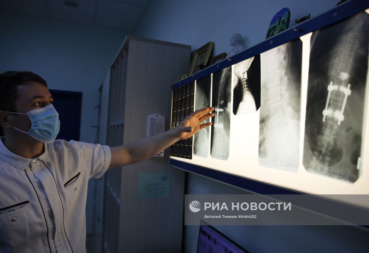 Работа спинальных хирургов в Краснодарской краевой больнице