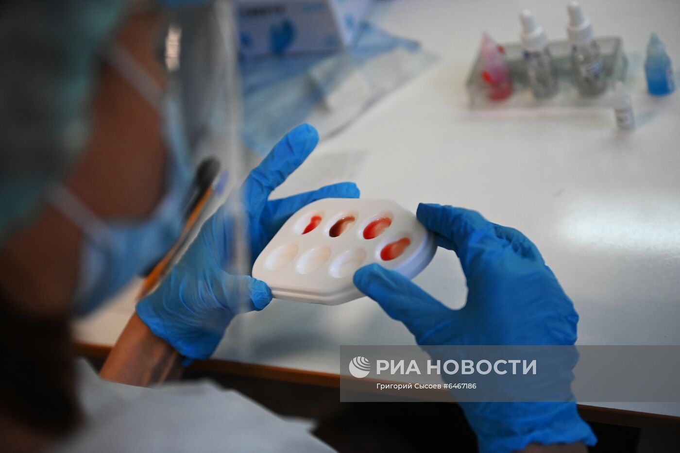 Сдача донорской плазмы с антителами к COVID-19