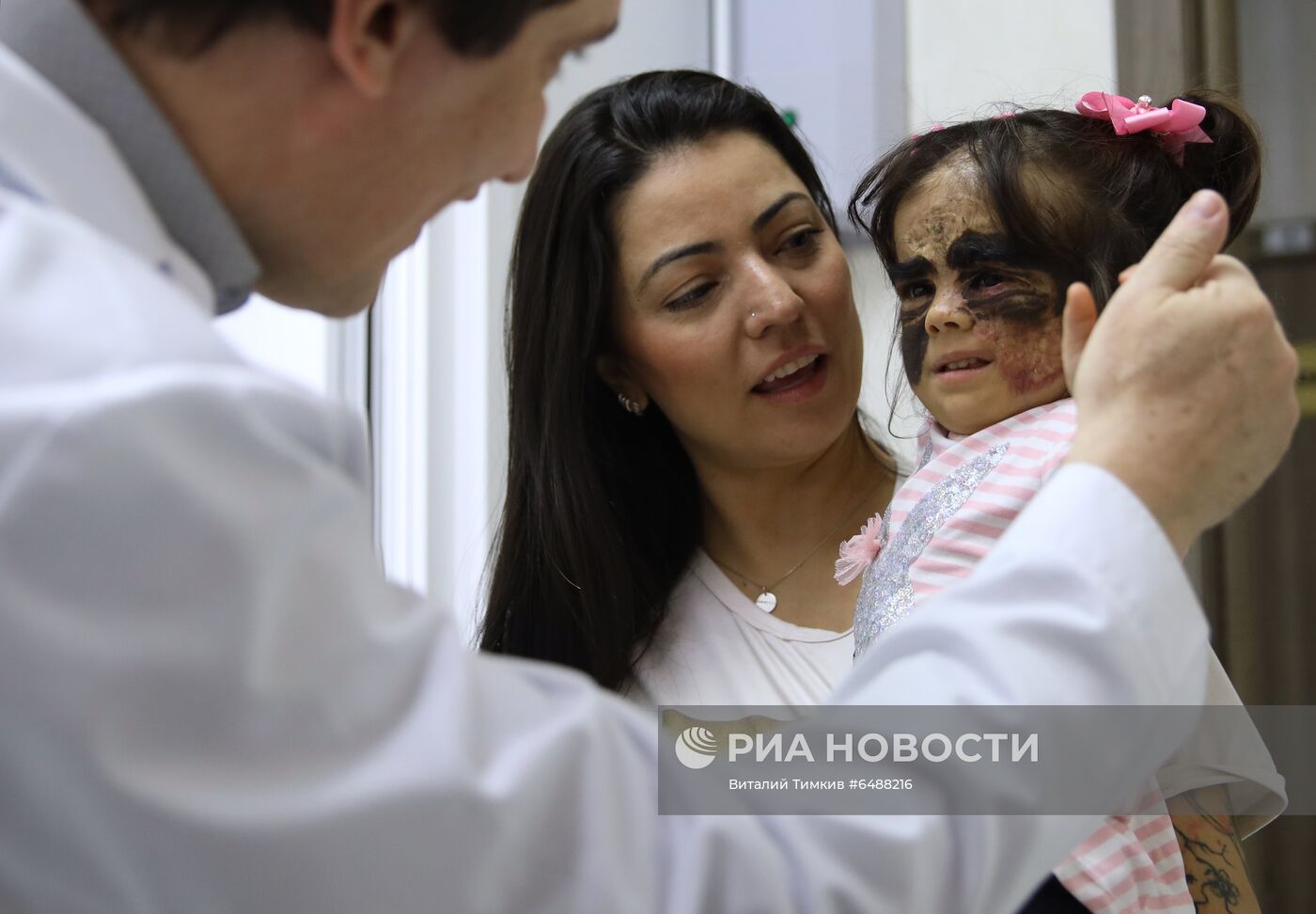 Лечение американской девочки с родимым пятном на лице в Краснодаре 