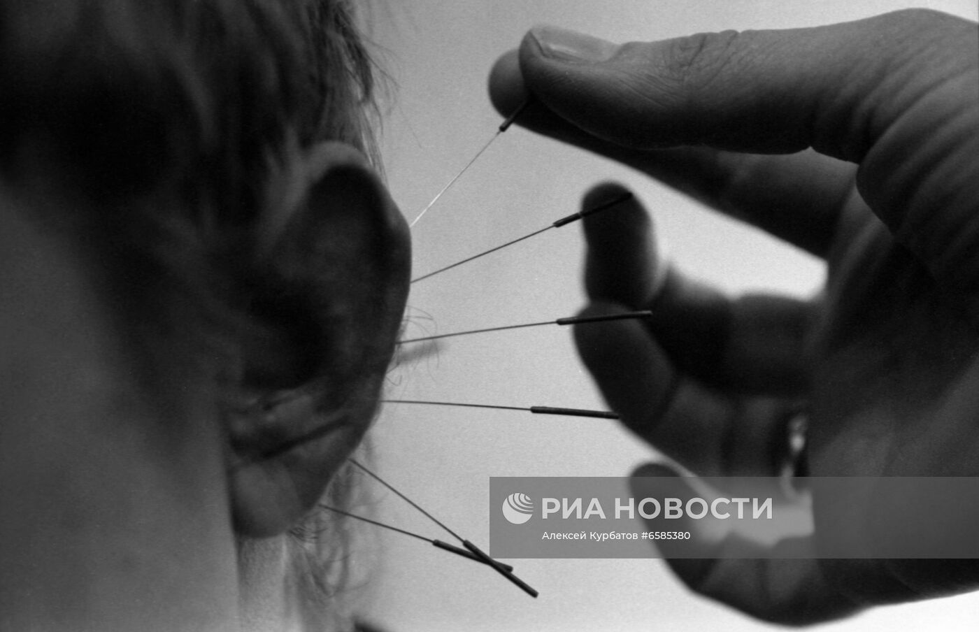 ЦНИИ рефлексотерапии