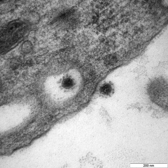 Центр "Вектор" опубликовал фото дельта-штамма коронавируса