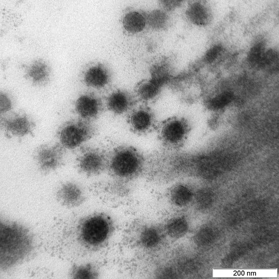 Центр "Вектор" опубликовал фото дельта-штамма коронавируса