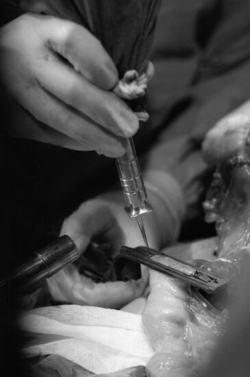 Универсальный лазерный скальпель