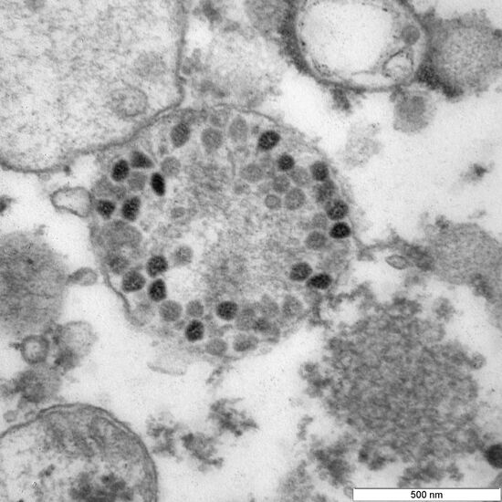 Фото вирусных частиц COVID-19 штамма "омикрон"