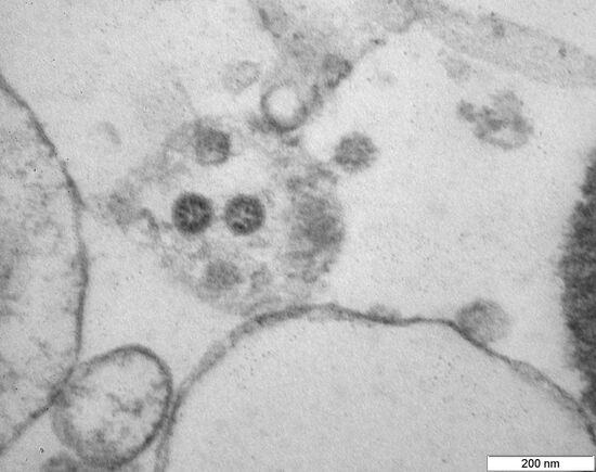 Фото вирусных частиц COVID-19 штамма "омикрон"