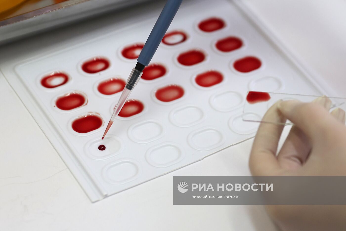 Национальный день донора в Краснодаре