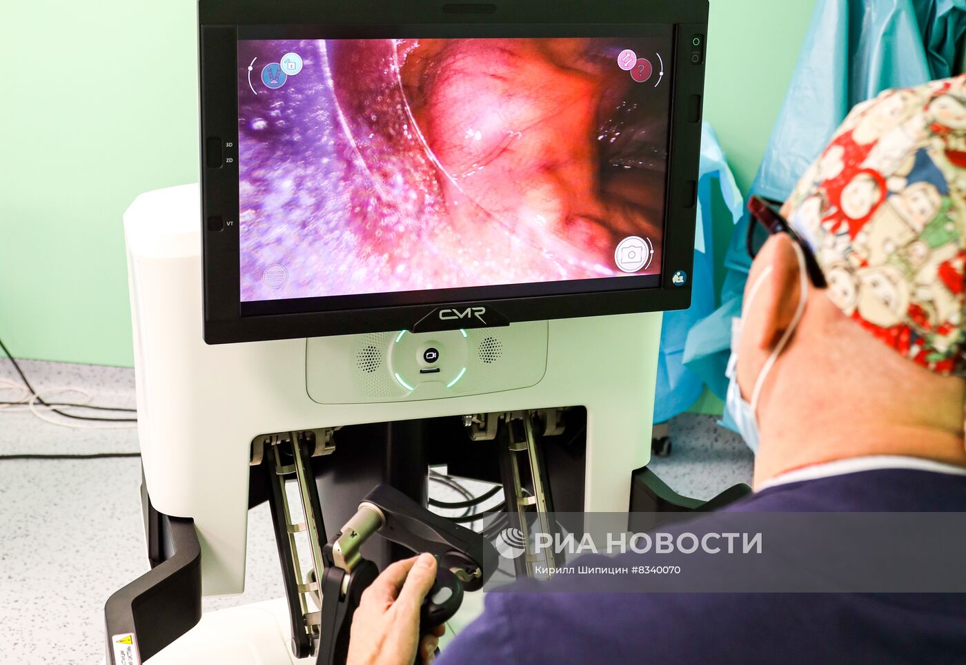 Проведение операции ребенку при помощи роботизированной системы в Иркутске